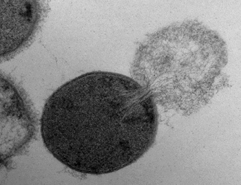 Image: Transmission electron microscopy image of a Streptococcus pyogenes cell experiencing lysis after exposure to the highly active enzyme PlyC (Photo courtesy of Daniel Nelson, UMD).
